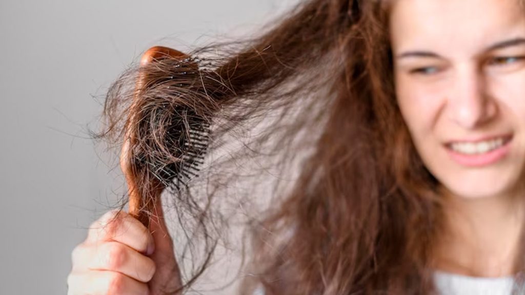 Limit Teasing and Backcombing