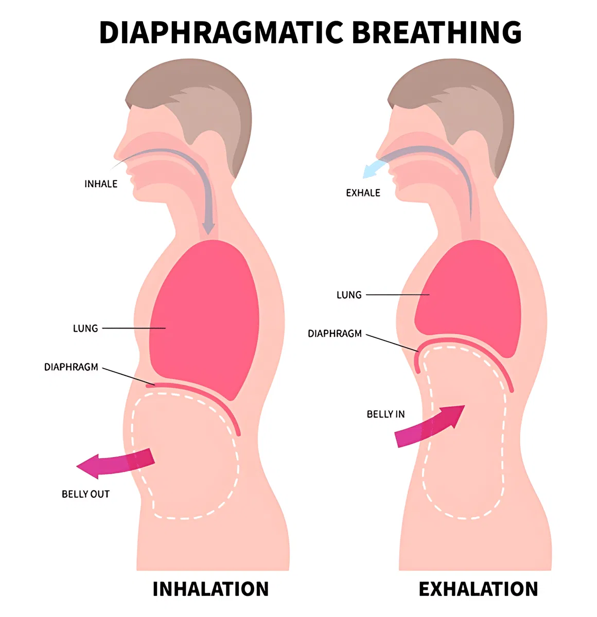 Techniques to Avoid Singing From the Throat