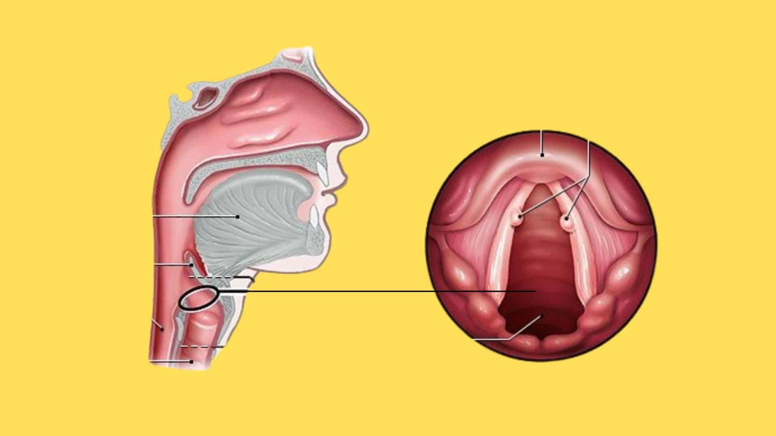 Understanding Vocal Nodules